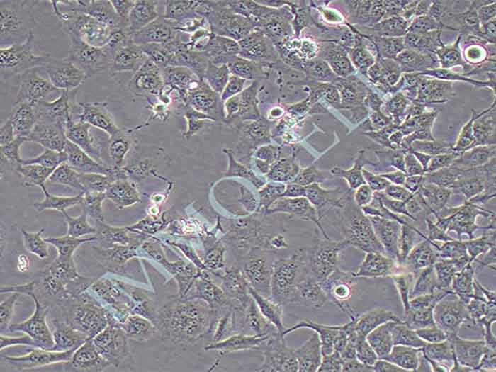NCI-H1975细胞细胞图片