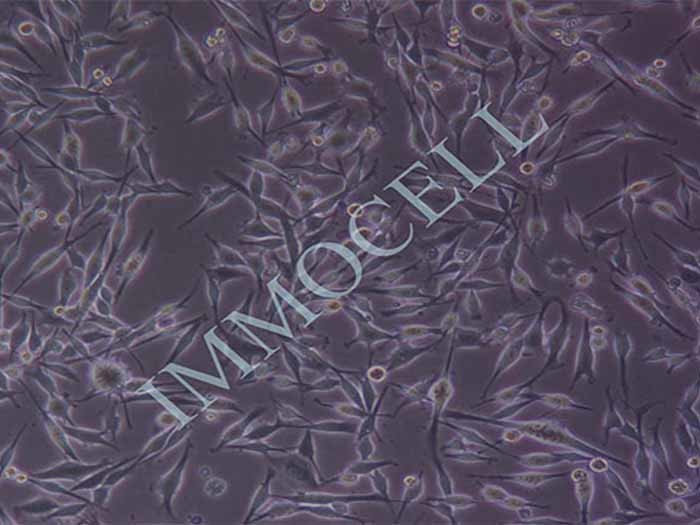 M14人黑色素瘤细胞图