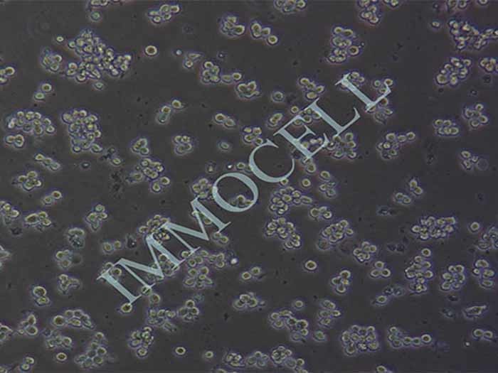 Raji细胞细胞图片
