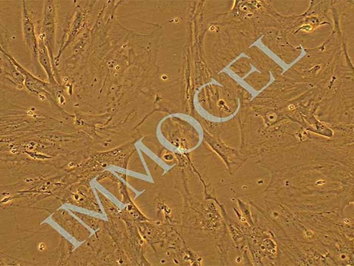 T/G HA-VSMC细胞图片