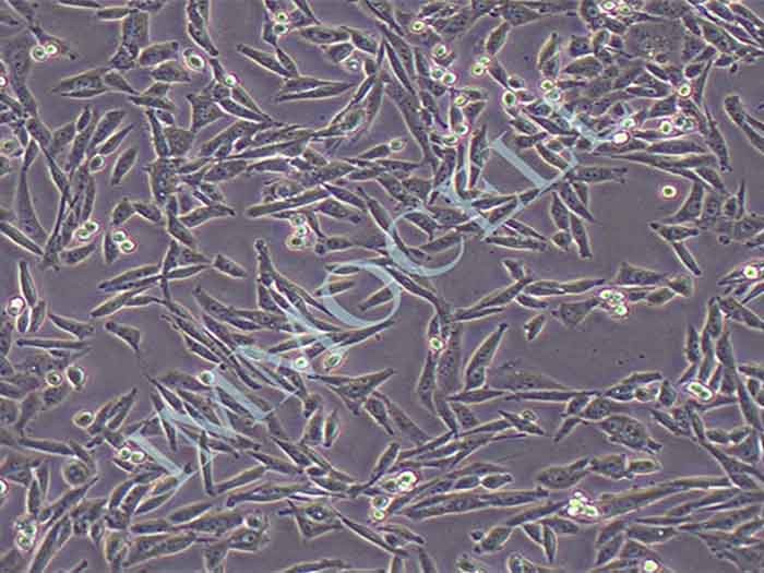 人胚肺成纤维细胞图片