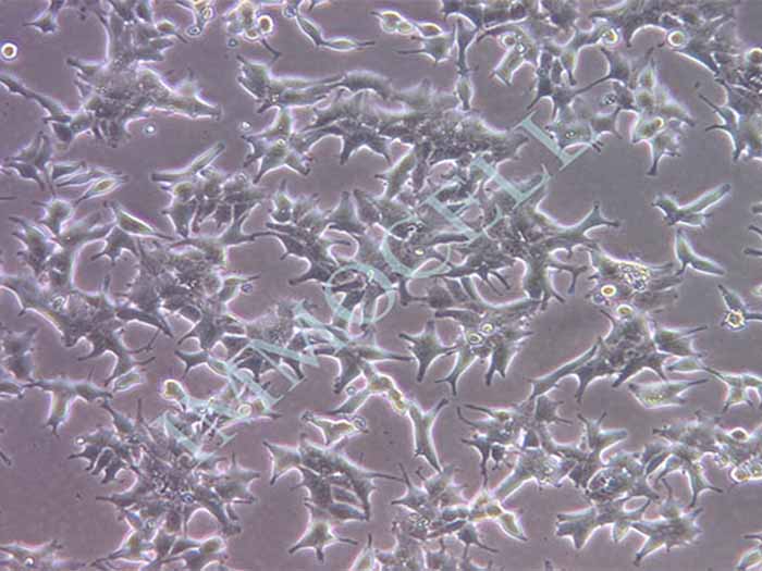 22Rv1细胞细胞图片