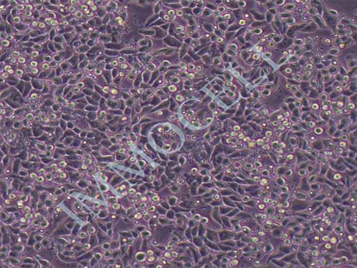 MDA-MB-468细胞图片