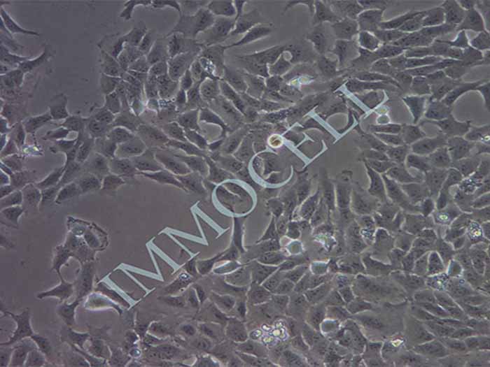143B细胞细胞图片