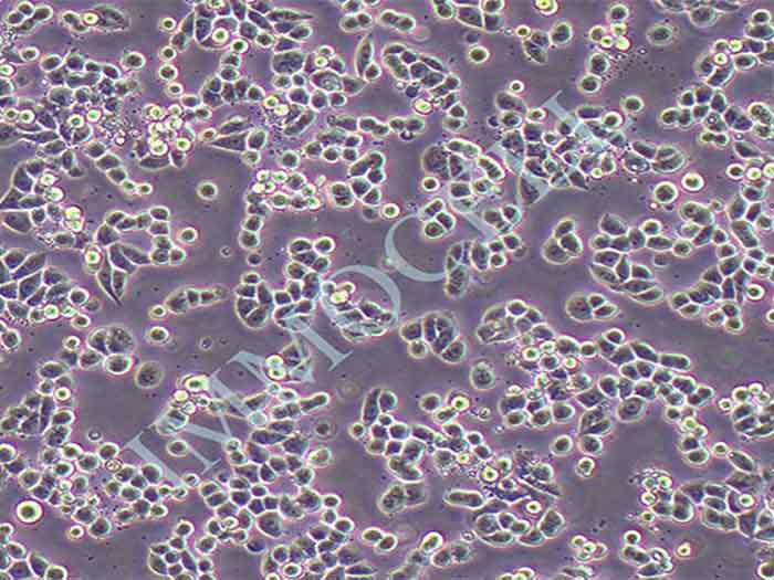 MDA-MB-453人乳腺癌细胞（STR鉴定正确）