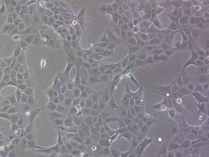 NCI-H2228细胞细胞图片