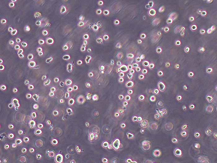 YT细胞细胞图片