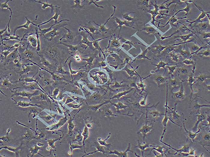B16BL6细胞细胞图片