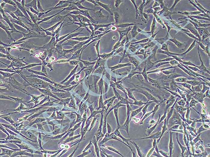 TC-1小鼠肺上皮细胞图片
