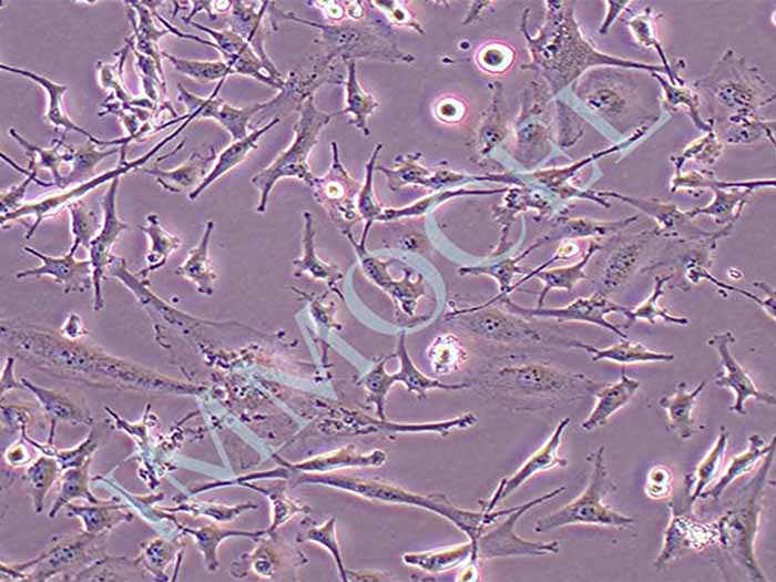 U251 MG/TMZ细胞图片