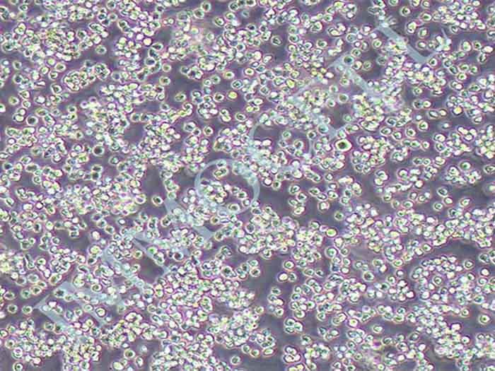Nalm6-LUC-puro人B淋巴白血病细胞图片