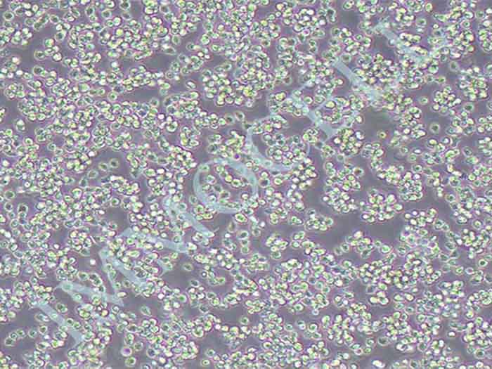 Nalm6-LUC细胞图片