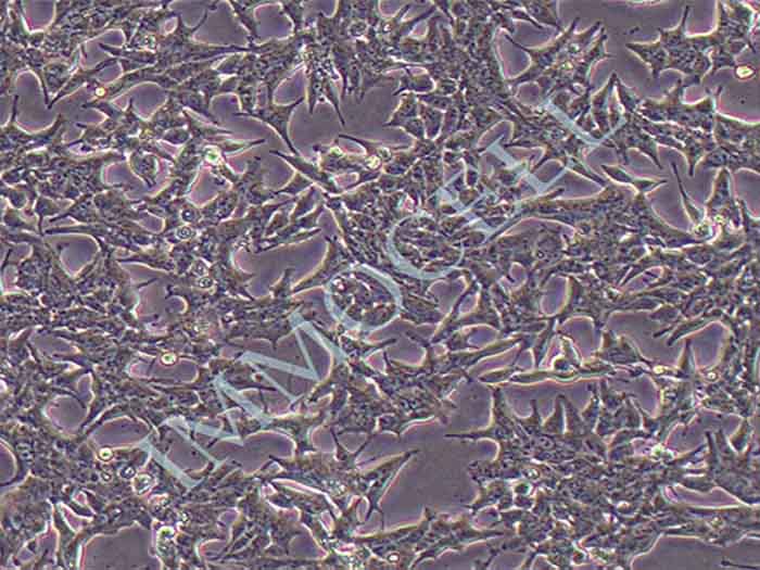 22RV1-LUC-PURO人前列腺癌细胞图片