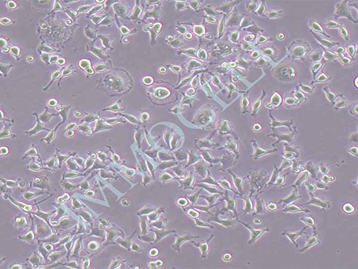 小鼠成纤维细胞-绿色荧光蛋白图片