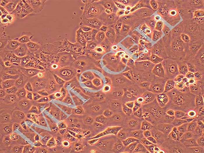 OVCAR-3细胞图片