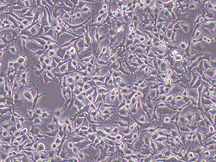 NCI-H3122细胞图片