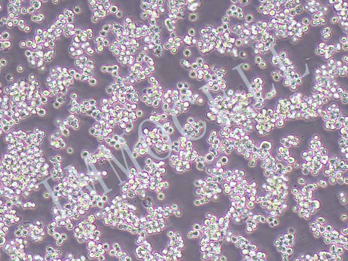 人Burkitt`s淋巴瘤细胞-荧光素酶标记图片