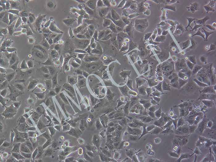 MCF-7-LUC细胞图片