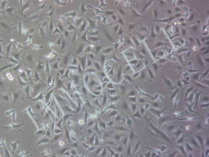A549-RFP人非小细胞肺癌细胞图片