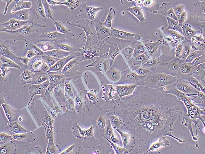 NCIH226-LUC细胞图片