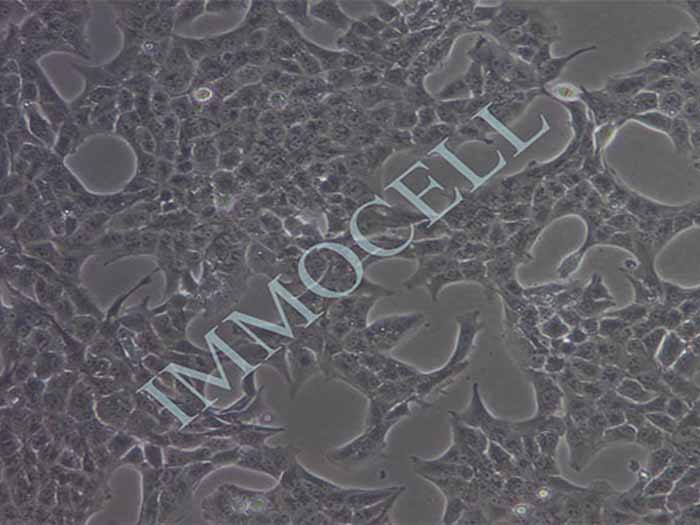 SN12-PM6-LUC人肾癌细胞图片