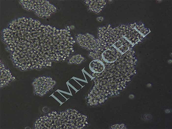 人淋巴瘤细胞Raji-LUC-eGFP说明书.pdf细胞图片