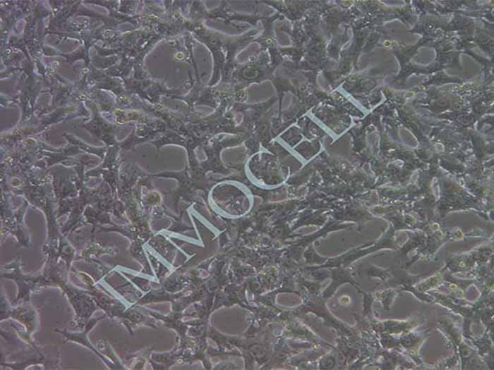 小鼠肝癌细胞-荧光素酶标记图片