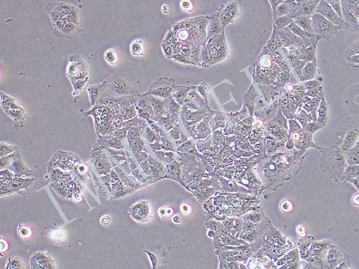 caco2荧光素酶细胞图片