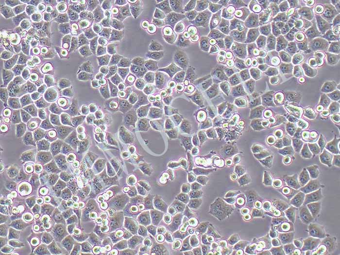 CNE2-LUC细胞图片