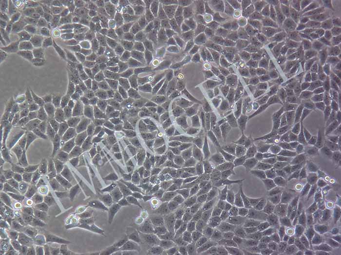HGC-27细胞细胞图片