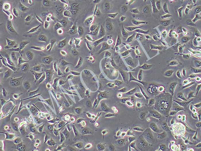 AGS-plv-luc细胞图片