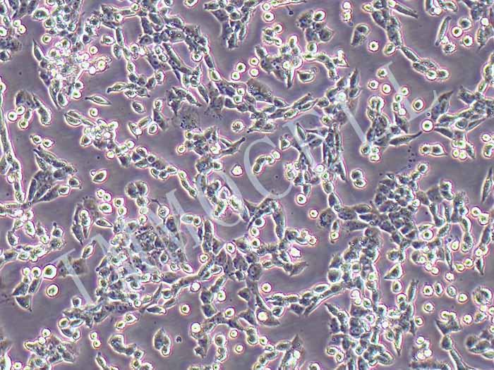 llc-GFP细胞图片