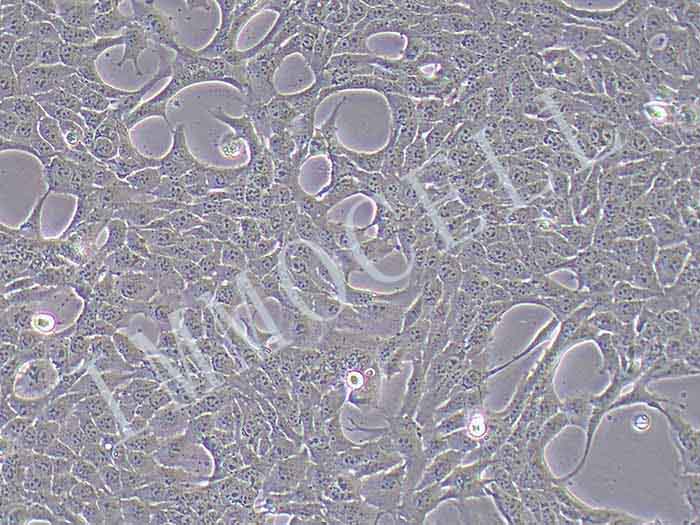 T47D-LUC细胞图片